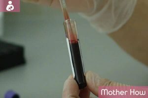 blood-tests