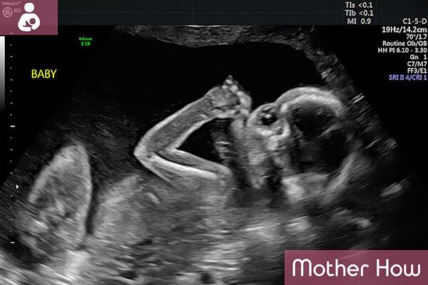 21-weeks-ultrasound