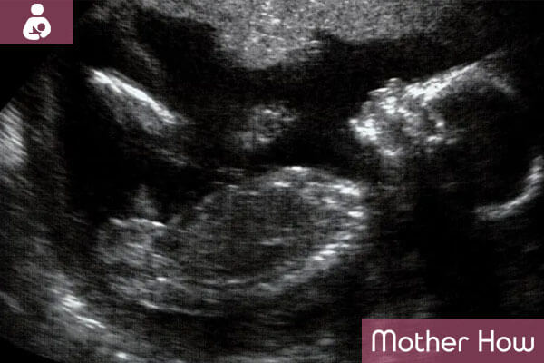 23-weeks-ultrasound