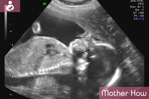 26-weeks-ultrasound
