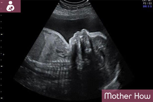 29-weeks-ultrasound