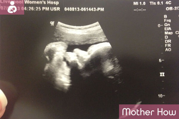 38-weeks-ultrasound
