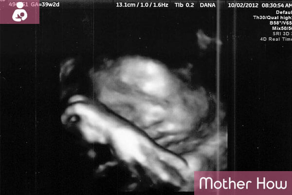 39-weeks-ultrasound