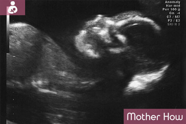 40-weeks-ultrasound
