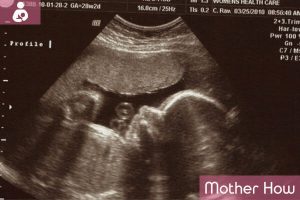 9 Months Pregnant: Signs, Symptoms & the Coming Labor - MotherHow