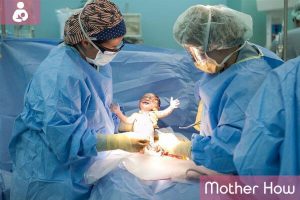 C-Section: Indications, Procedure, Pros & Cons of the Operation