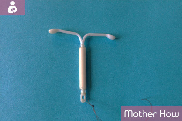 Hormonal-IUD
