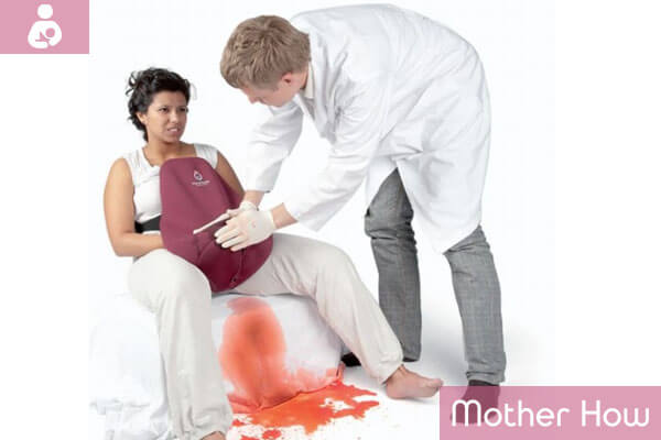 Intensive-postpartum-bleeding